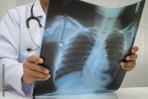 Foto Doctor examining lung radiography xray film.