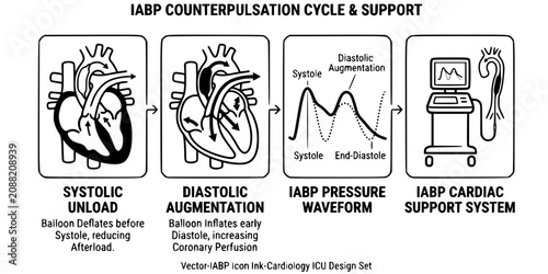 фотографія IABP Counterpulsation Ink Black White-Cycle Diastolic Augment Systolic Unload-Ca