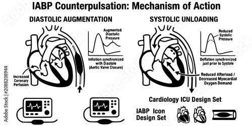 Принти на полотні IABP Counterpulsation Ink Black White-Cycle Diastolic Augment Systolic Unload-Ca