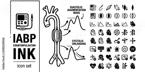 Tableau sur toile IABP Counterpulsation Ink Black White-Cycle Diastolic Augment Systolic Unload-Ca