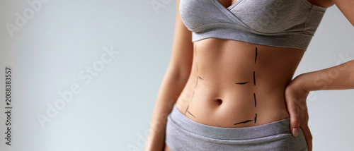  Slim female torso with surgical markings for tummy tuck or liposuction. Body contouring and mommy makeover plastic surgery concept, wide banner with copy space.