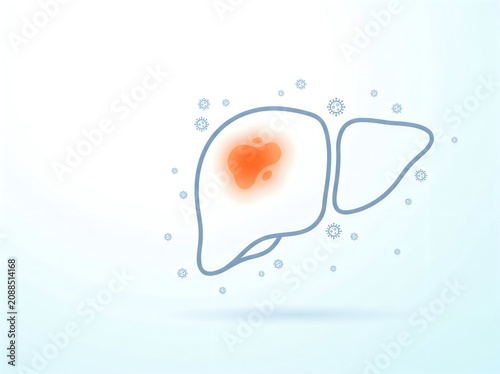 Liver with inflamed orange spot surrounded by viruses or bacteria on light blue background