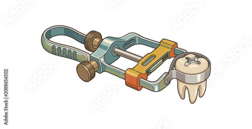 Fotografía Dental Matrix Retainer and Molar Tooth Illustration