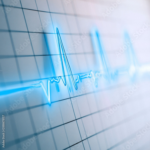 blue ecg line on a white background with a bit of autofluorescence