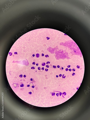 White blood cells