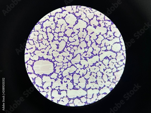 Gram positive bacteria