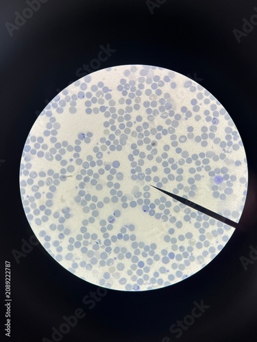 Reticulocyte 