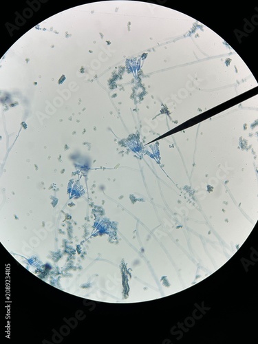 Penicillium Microscopic Morphology Under Light Microscope.