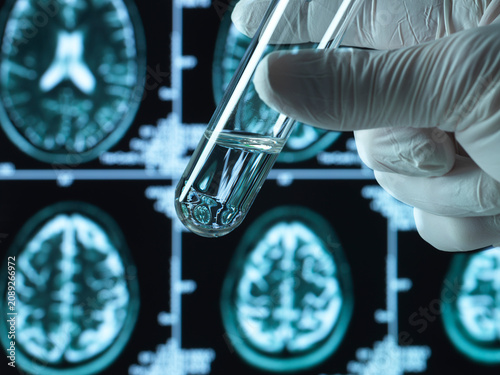 Pharmaceutical research into brain disorders including dementia and alzheimer's