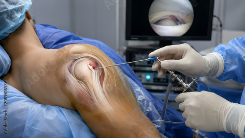 Shoulder joint labral tear Bankart lesion clinical procedure concept showing arthroscopic repair, realistic anatomy, orthopedic treatment setting for medical education and patient communication buyers