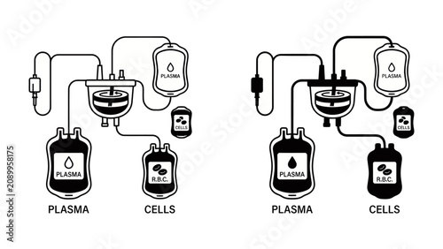 Konstfotografi Blood Component Separation Device Diagram: A simplified illustration displays a diagram of a device designed to separate blood components, illustrating the processes for plasma and cell collection