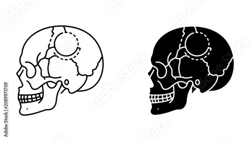 Tableau sur toile Skull Illustration Set: A side profile of a human skull presented in two distinct styles, one as a clean outline and the other as a solid black silhouette, showcasing anatomical detail