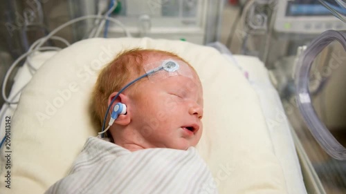 High angle view of a sleeping newborn baby swaddled in a hospital incubator while undergoing a hearing screening test with electrodes and sensors attached to its head and ear