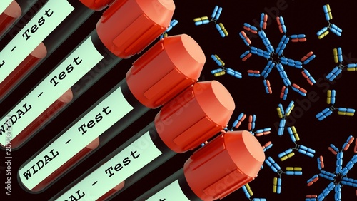 Cuadro en lienzo A 3d rendering of medical blood collection tubes with red caps bearing labels printed with WIDAL - Test, pentameric IgM antibody structure and monomeric IgG antibody structures