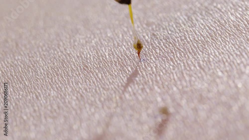 Honey Bee Stinging Human Skin with Visible Stinger Close Up Macro