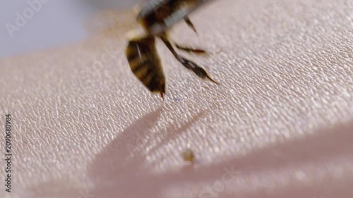 Honey Bee Stinging Human Skin with Visible Stinger Close Up Macro