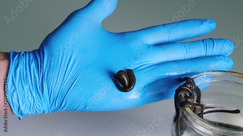 Medical Leech on Gloved Hand During Hirudotherapy Preparation Close Up
