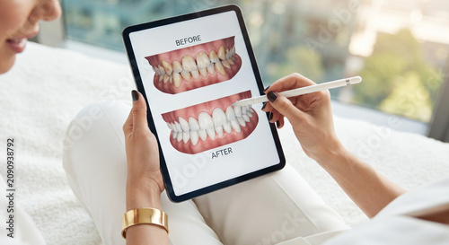 Obraz na płótnie Woman Holding Digital Tablet Showing Before and After Dental Treatment Results