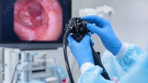 Colonoscopy procedure with endoscope during colorectal cancer screening, gastrointestinal examination for colon polyps, inflammatory bowel disease diagnosis, early detection and prevention