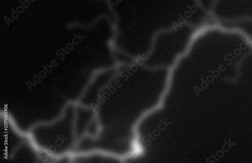 Konstfotografi Angiographic imaging of cerebral arterial blood vessels with contrast highlighti