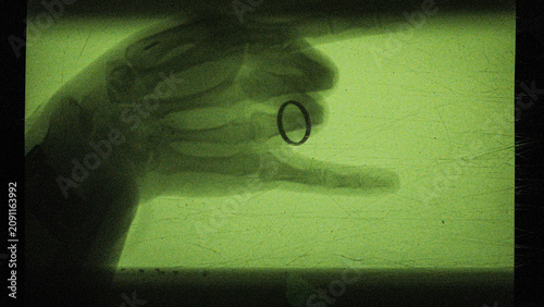 Photos the process of creating an X-ray image of a living person's hand, captured on ca