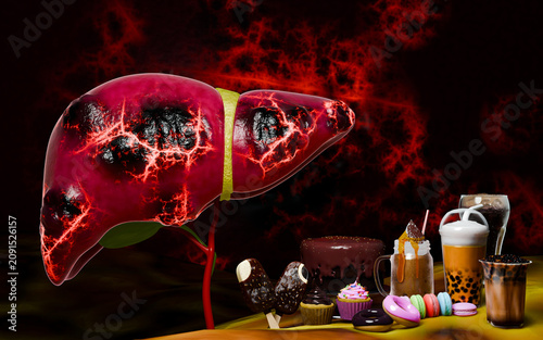 Liver Fat Accumulation From Sugary Ultra Processed Foods and Modern Junk Food Diet 3D Rendering