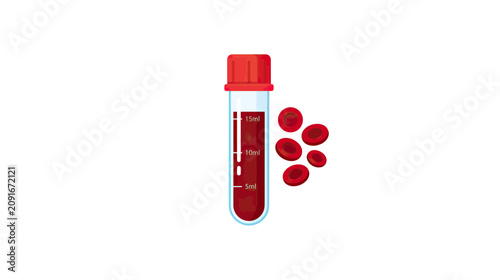 Obraz na płótnie Blood Sample Test Tube with Red Blood Cells, Medical Laboratory Analysis