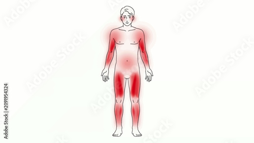 Stressed man experiencing widespread body pain with red highlighted areas indicating physical discomfort and muscle tension on a clean white background