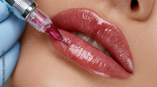 Lip cosmetic injection lip filler close up glossy lip needle during cosmetic lip filler injection, close up glossy lip