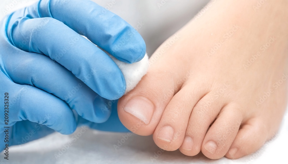 Fototapeta premium Medical professional in blue gloves cleaning a foot with cotton