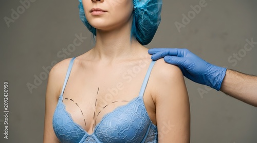Surgical markings on a woman's chest before breast augmentation or reduction procedure