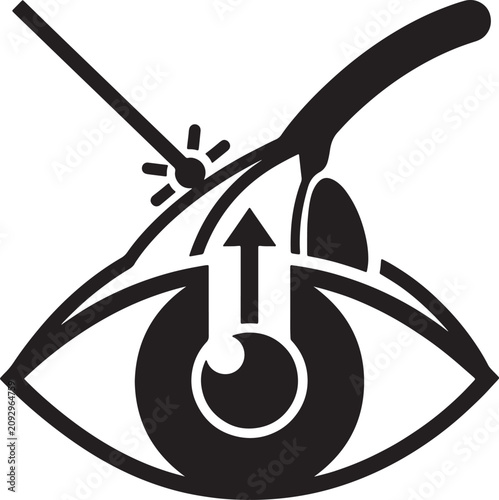 Tableau sur toile Laser eye surgery procedure showing cornea reshaping treatment for vision correction with refractive therapy
