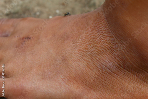 Quadro su tela brown leather texture on men's ankles with detailed pores and wrinkle lines