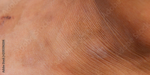 Bild auf Leinwand brown leather texture on men's ankles with detailed pores and wrinkle lines