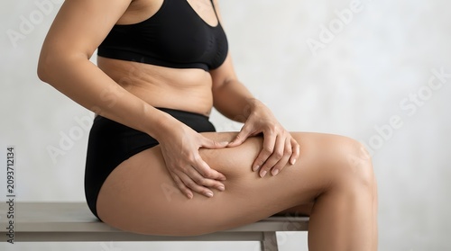 Woman Checking Cellulite on Thigh Skin Sitting on Bench, Body Care Concept
