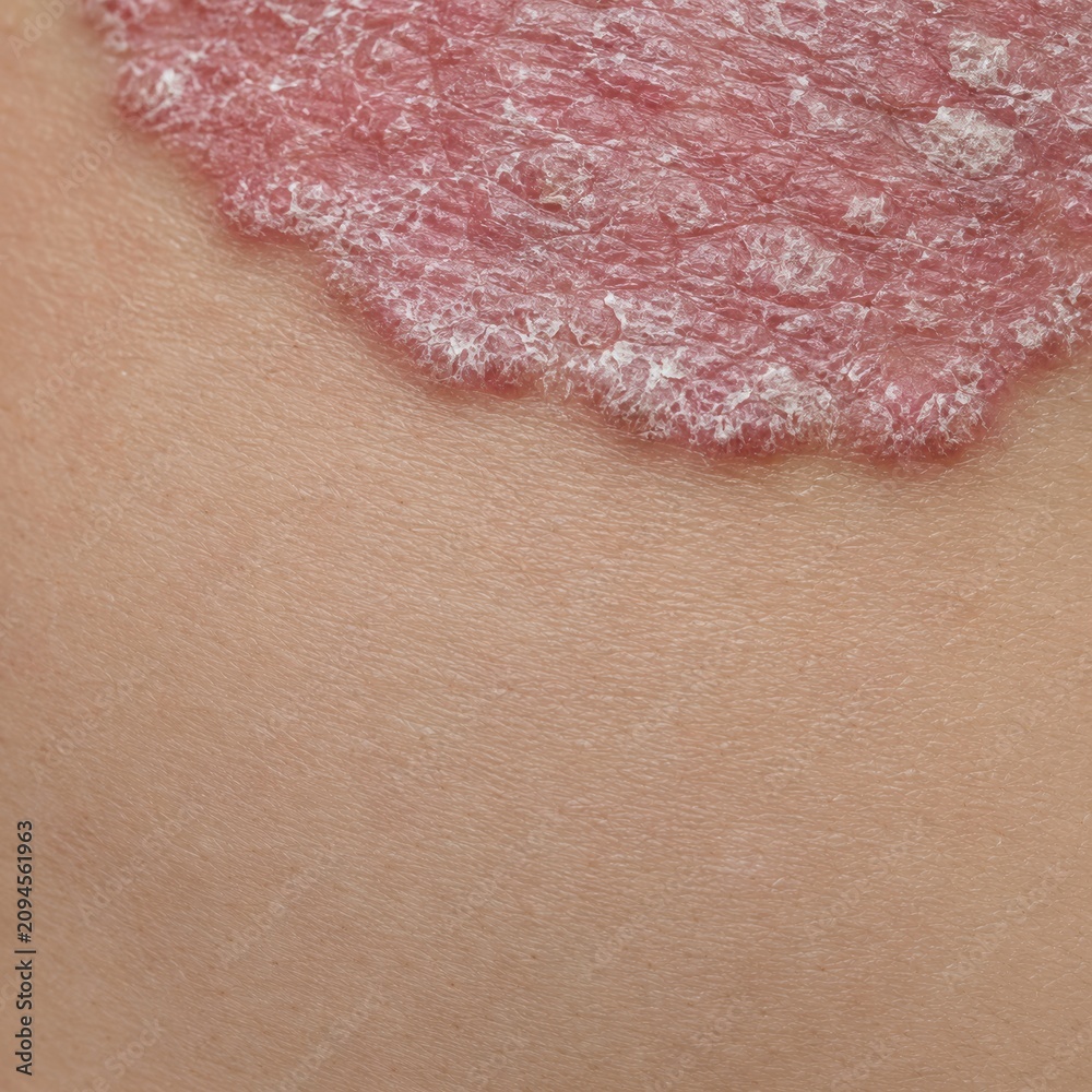 Fototapeta premium Close-up view of delicate lace fabric with detailed texture on smooth skin background in soft pink tone