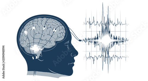 Human brain with electrodes and digital neural frequency graph