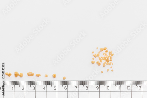 Kidney stones of various sizes with a ruler for medical measurements and urological documentation