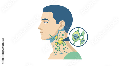 Lymphoma Awareness – Anatomical Illustration of the Human Lymphatic System in the Neck
