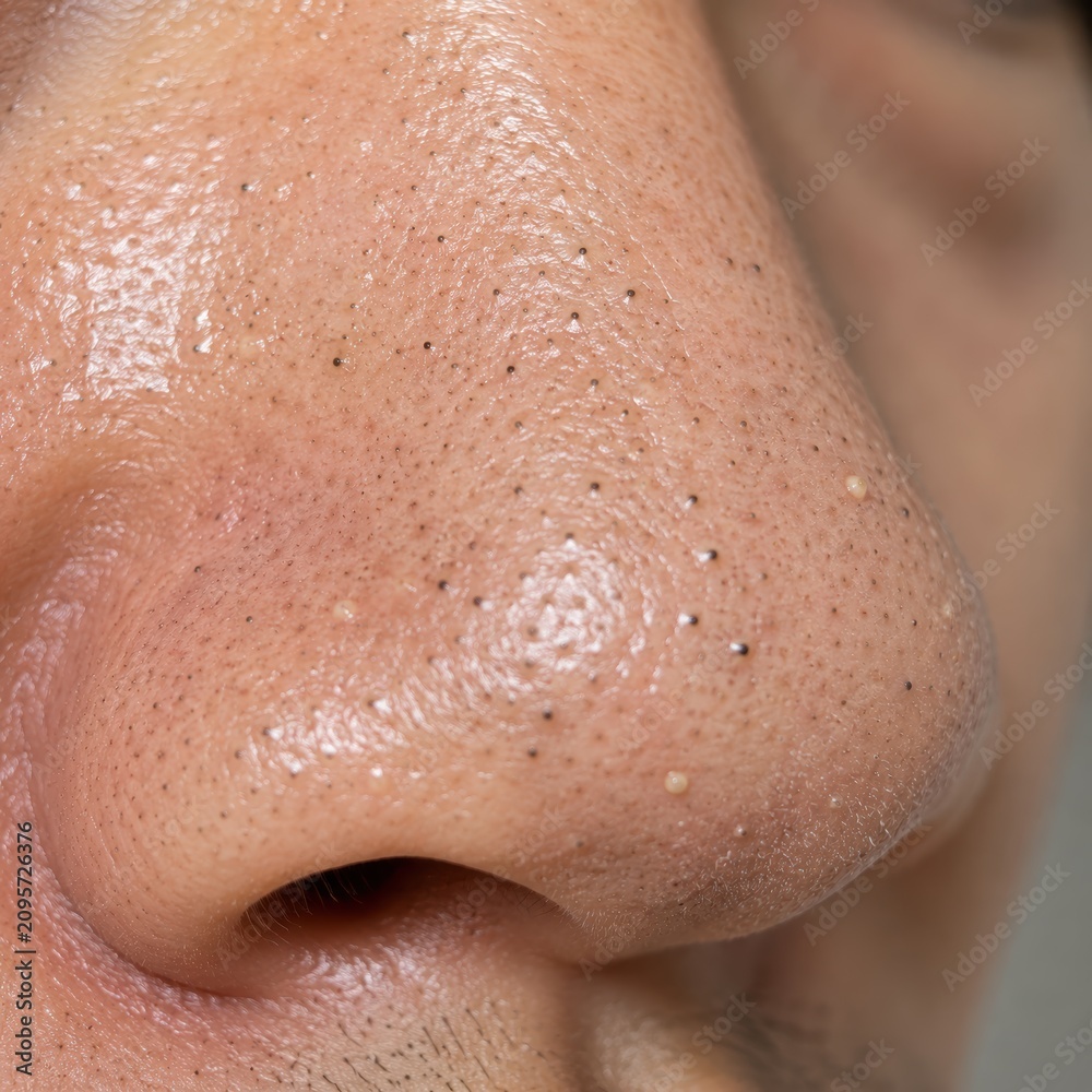 Fototapeta premium Close-up of human nose with visible blackhead and skin pores showing detailed skin texture and imperfections