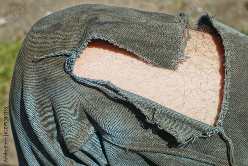 Schilderij op canvas Close-up of torn work dirty blue jeans with a big hole in the knee