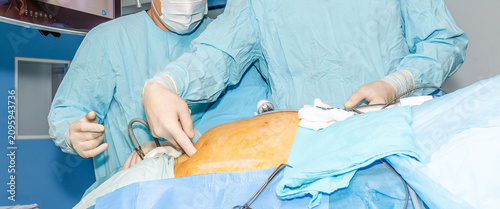 Surgical team pointing at patient abdomen during laparoscopic operation in hospital clinic.