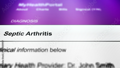 Photos Generic Health Portal with Leg Health Problem Diagnosis - Septic arthritis