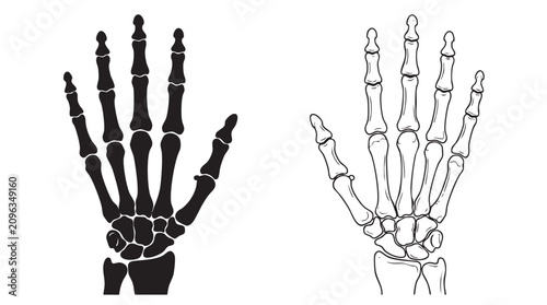 Quadro su tela hand x-ray black silhouette with line art vector illustration