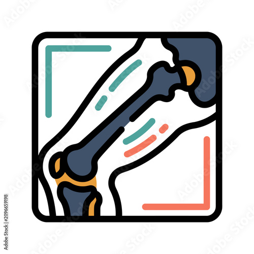 Femur Leg Bone X-Ray Icon for Trauma Surgery