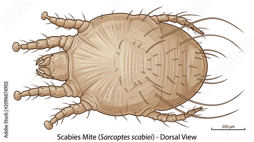 Scabies Mite Insect Close Up View.