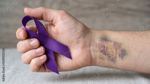 Hand holding purple ribbon with bruise on wrist, concept of domestic violence awareness and support