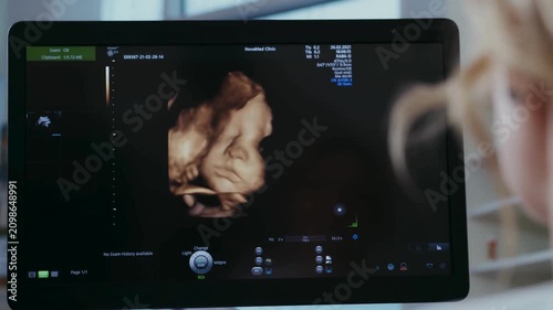 Expectant mother watching 3D fetal ultrasound scan on clinic monitor
