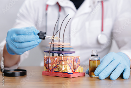 Canvas Print Doctor trichologist applying topical treatment with dropper oil to anatomical sk