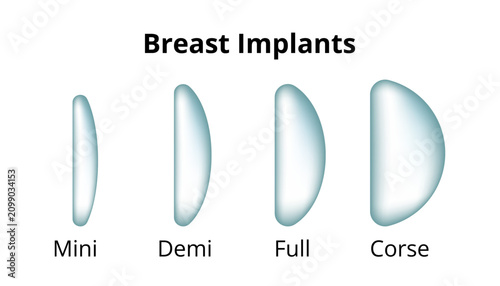Breast implants medical illustration showing varying projection profiles